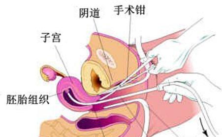 苏州妇科医院