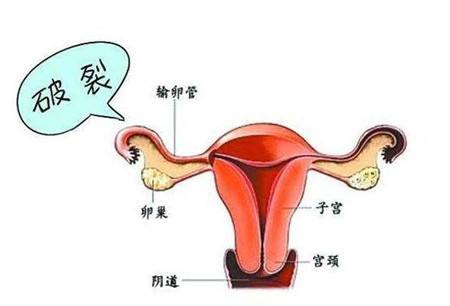 苏州看宫外孕好的医院_东吴医院妇科