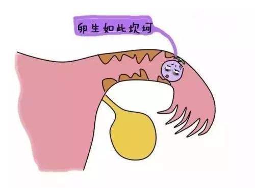 苏州治疗宫外孕费用_东吴医院怎么样
