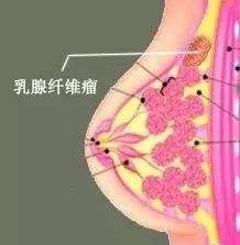 苏州看乳房哪个医院好_苏州东吴结合医院